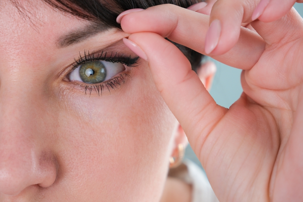 Blepharoplasty in Istanbul